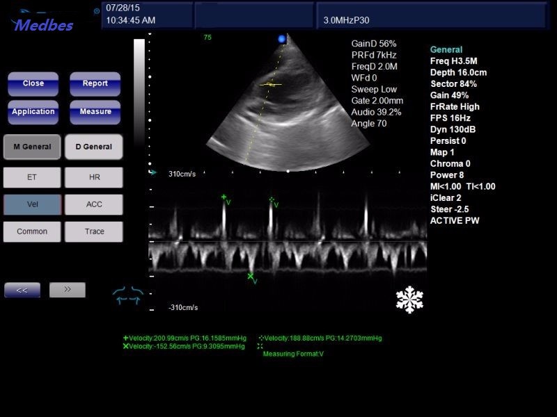 Tender Ultrasound 4D Digital Color Doppler Cheapest Ultrasound Machine Color Doppler Scanner