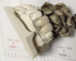 China Soft Elastic Nylon Trushine Invisible Denture wholesale