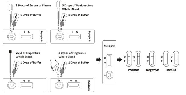 50ng/ML Myocardial Infarction Test Cassette Diagnosis Of Myocardial Infarction MI
