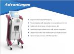 Most effective High Quality Thermage Skin Treatment Machine for Skin Treatment