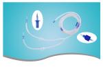 Disposable Sterile Infusion Catheter Customized CE Certificated