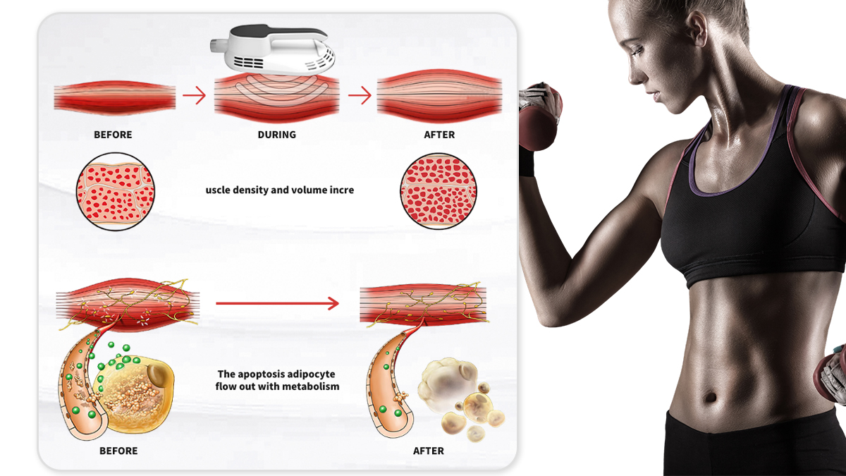 Ems Sculpting Machine 2 Handles Ems Body Sculpt Fat Removal Muscle Building EMS Shaping Slimming machine