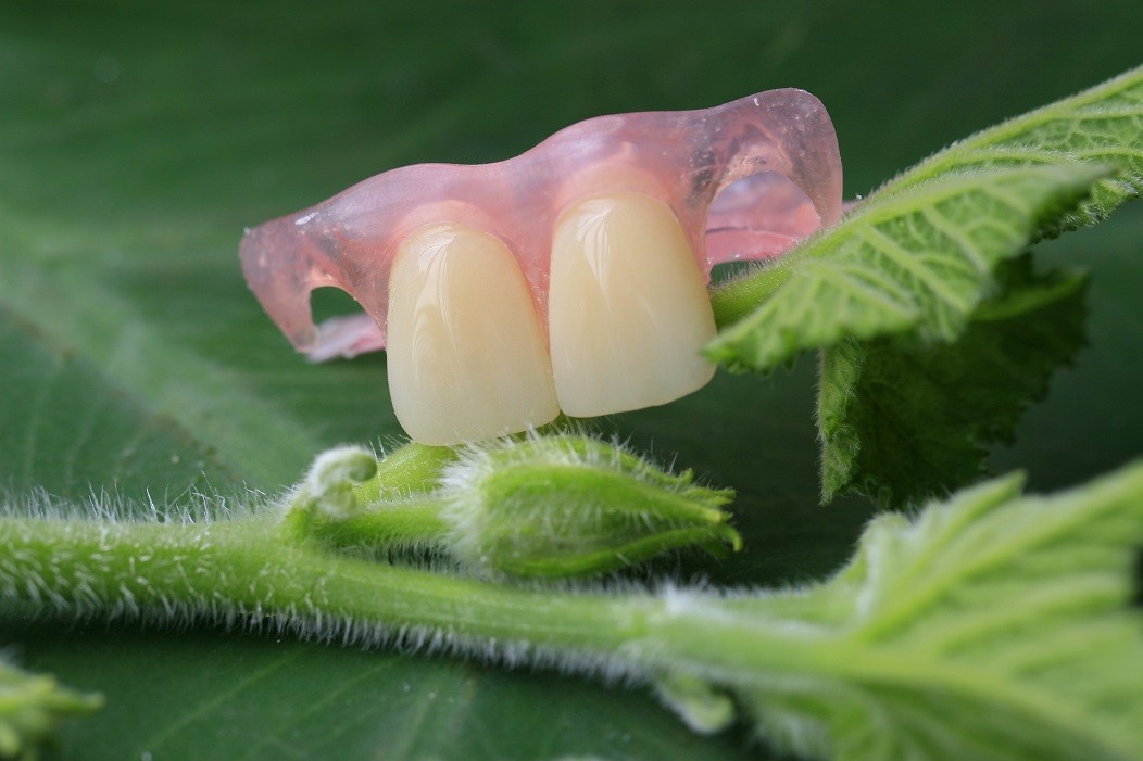 Temporary Soft And Elastic Valplast Invisible Denture