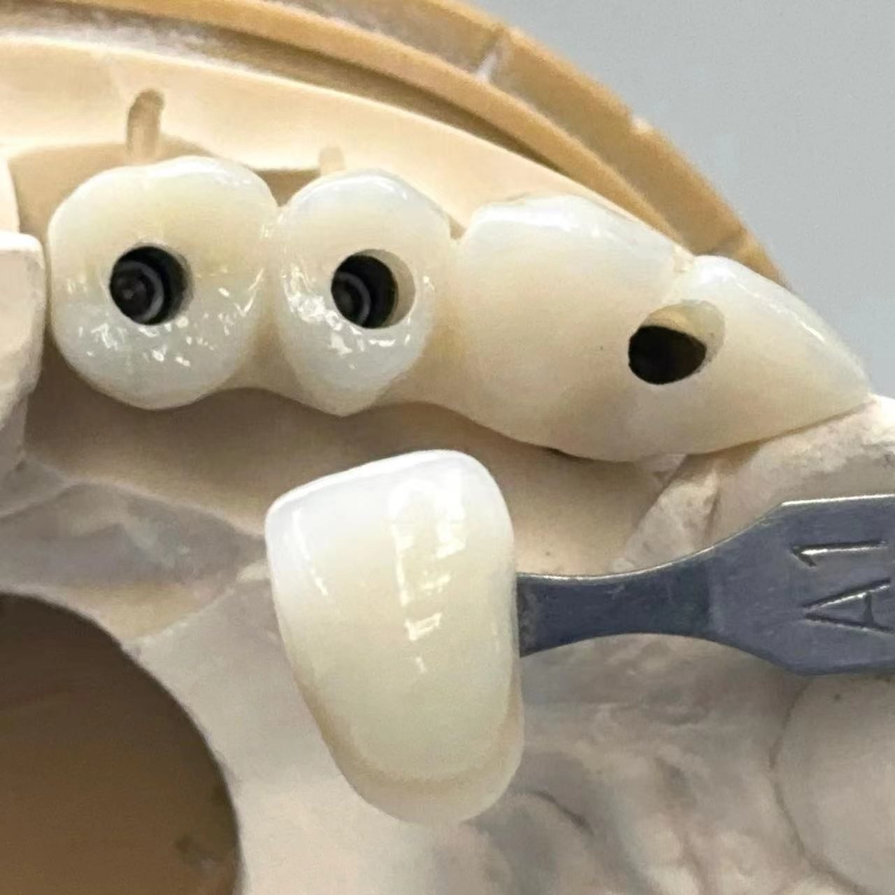 Porcelain Zirconia Cement Retained Screw Implant Hexagonal Head Shape for Custom Fit Esthetics