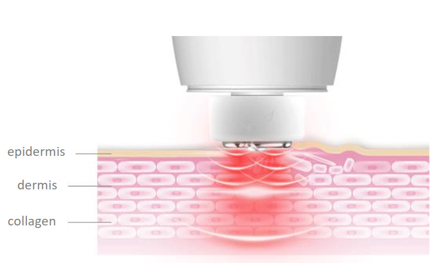 Skin Rejuvenation RF Beauty Instrument