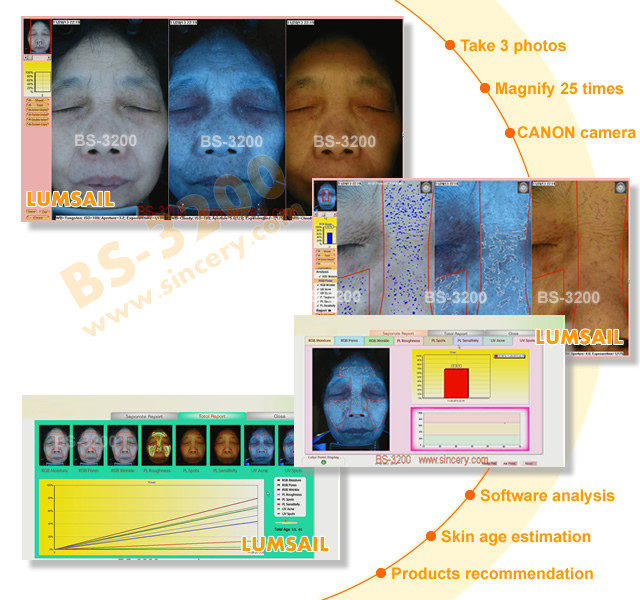 Auto - Analysis Skin Analysis Machine Lightweight With UV Voice System