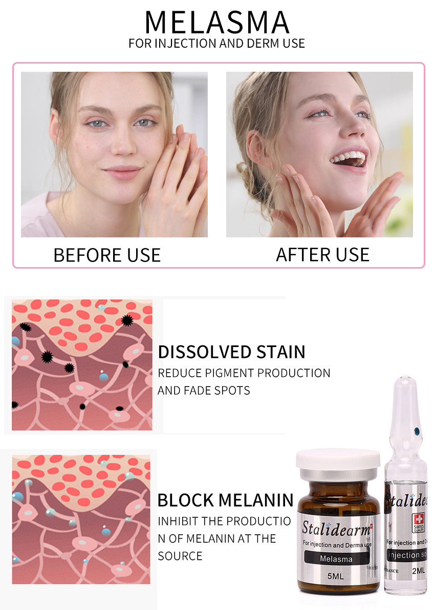 Melasma Injection Use Serum Safe And Good Effect Mesotherapy 5ml/bottle serum set