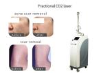 Clinic Salon Laser Beauty Equipment Multifunctional For Scar Removal