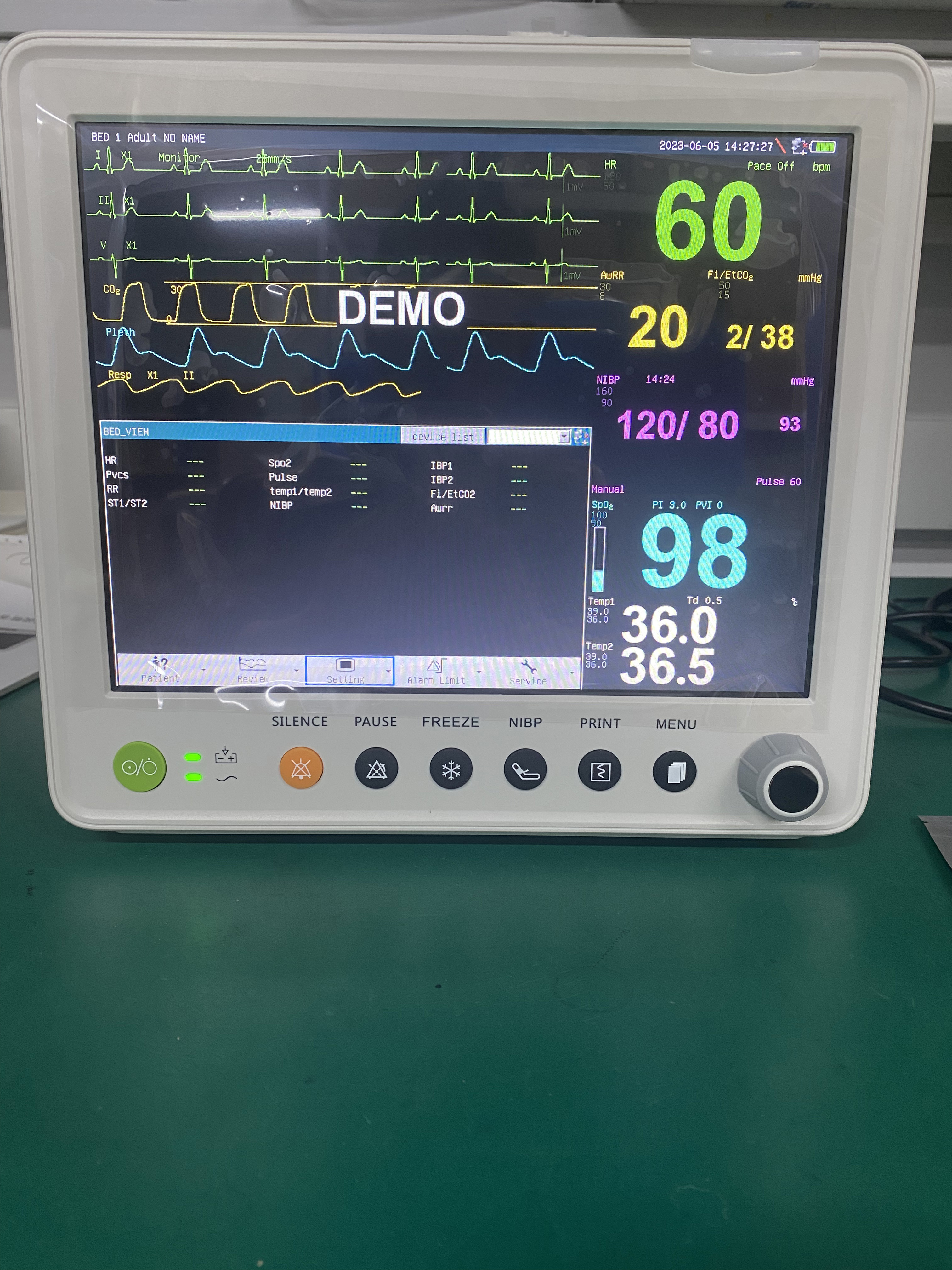 Portable Patient Monitor With Parameters Of ETCO2 ECG NIBP SPO2 RESP TEMP PR