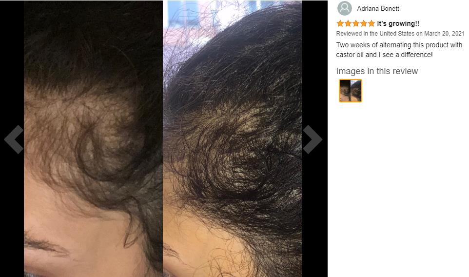 Customization Hair Growth Treatment Serum for Black Women Private Label