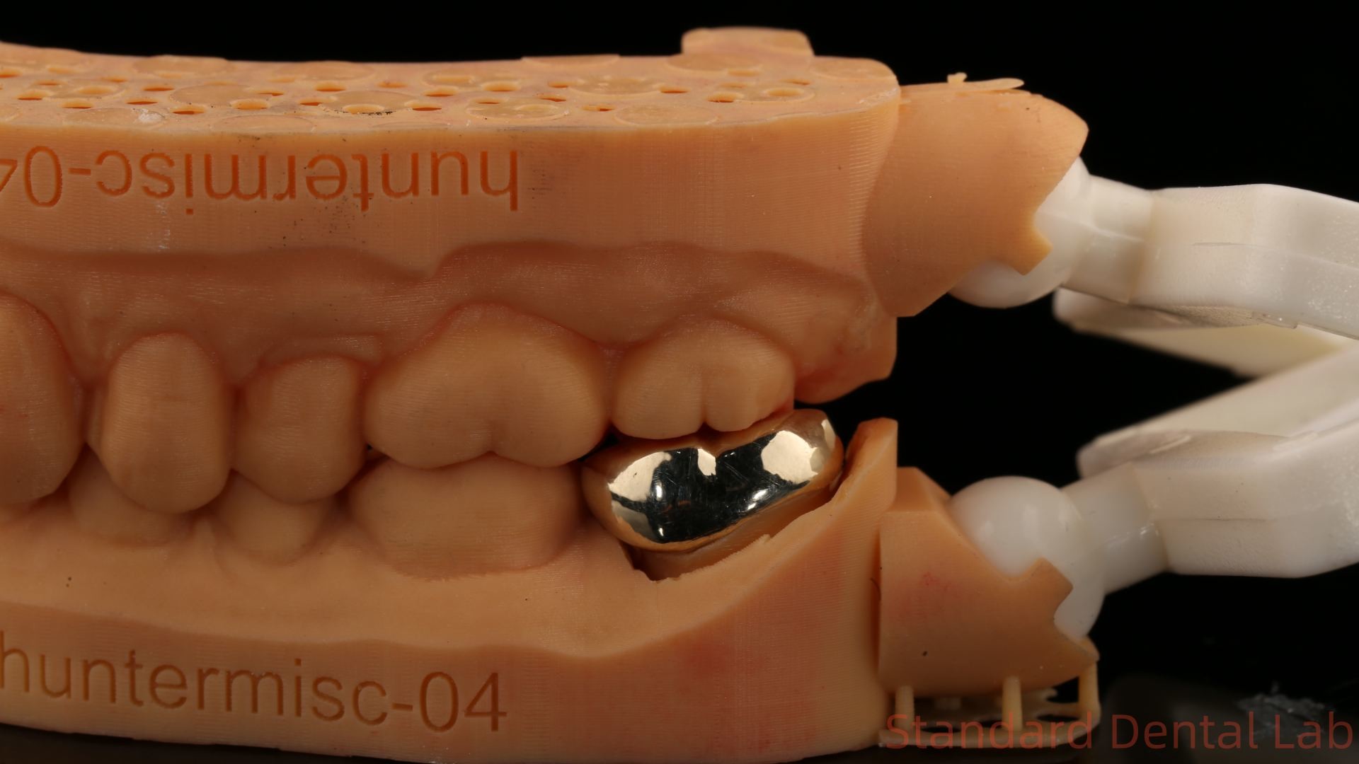 High Nobel Yellow Gold Crown Tooth Professional Ni Be Free ISO And FDA Approved China Dental Lab