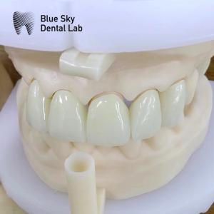 China Natural Esthetics Multi Layered Zirconia Crown High Strength Chemical Resistance wholesale