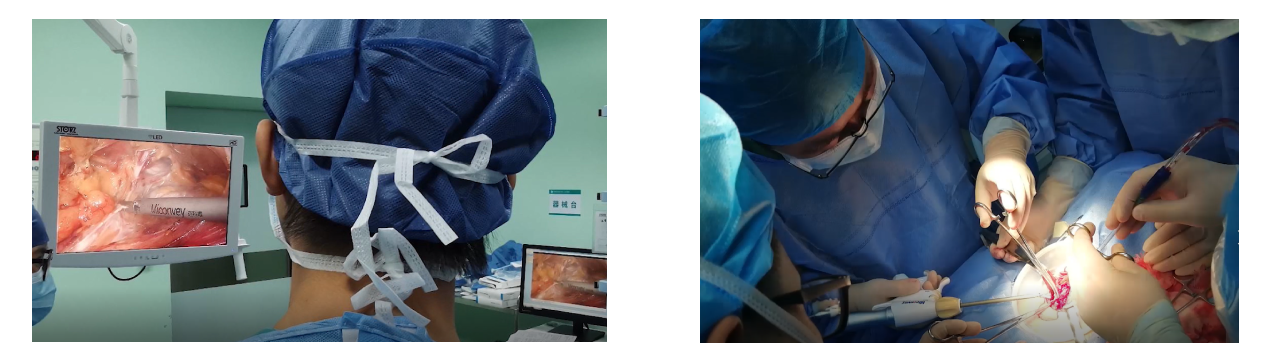 Disposable Ultrasonic Scalpel System Scissor-Type Scalpel applications