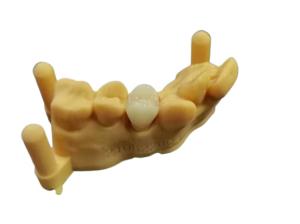 China OEM 3D Printing Flexible Acrylic Denture Dental lab Digital Design wholesale