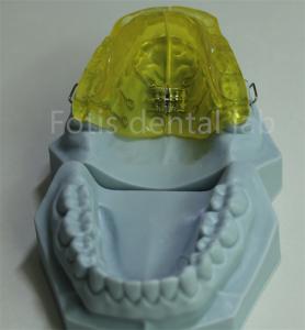 China Customizable Orthodontic Retainer for China Dental Lab wholesale