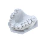 3d Dental Resin High Hardness Repair Type Model Resin