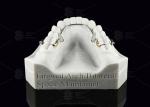 Lingual Arch Biliteral Space Maintainer Stainless Steel Teeth Space Maintainers