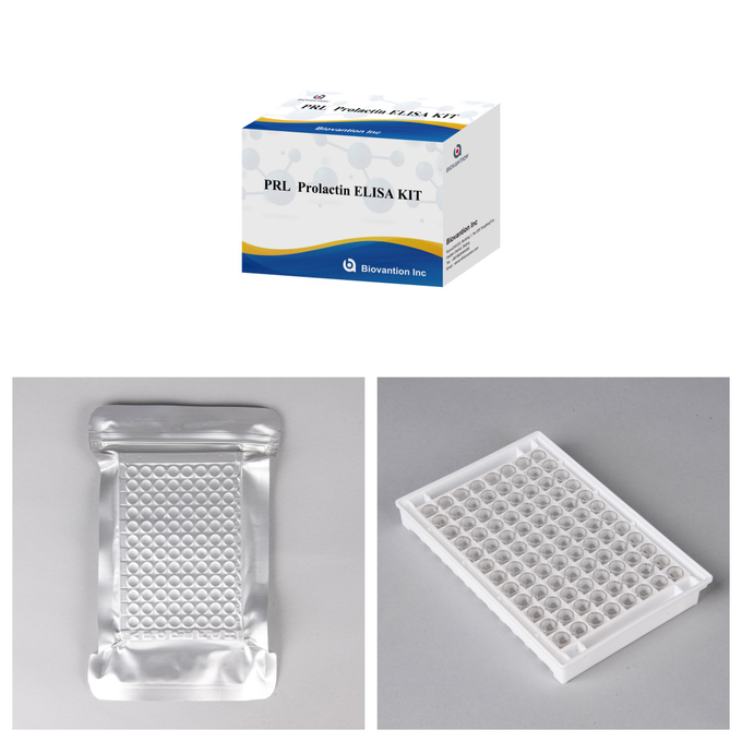 PRL Quantitative Human Hormones Diagnostic Detect Reagent Kit