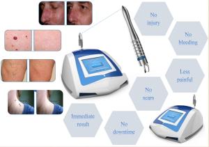 China 980nm Laser remove Skin tag,Spider Vein and Cherry Angonia/one time treatment is enough wholesale