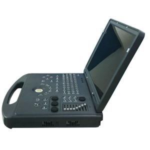 China Laptop color doppler Ultrasound Diagnostic Syste... wholesale