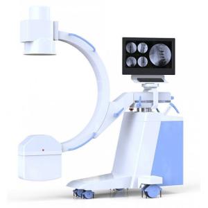 China High frequency Mobile digital C-arm wholesale