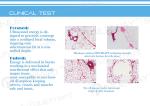 medical CE approved HIFU body slimming equipment