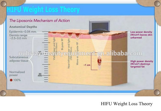 hifu slimming machine body theory.jpg