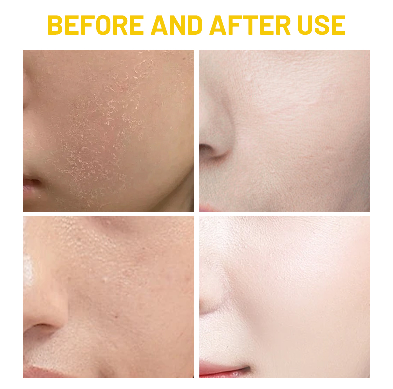 77.8% Rice Toner Niacinamide Brightening Face Moisturizer Hydrating Soothing Glow Skin Face Toner for Sensitive Skin