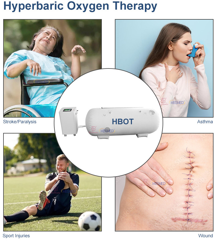 Hbot Therapy Oxygene Concentrator Hyperbaric Oxygen Chamber