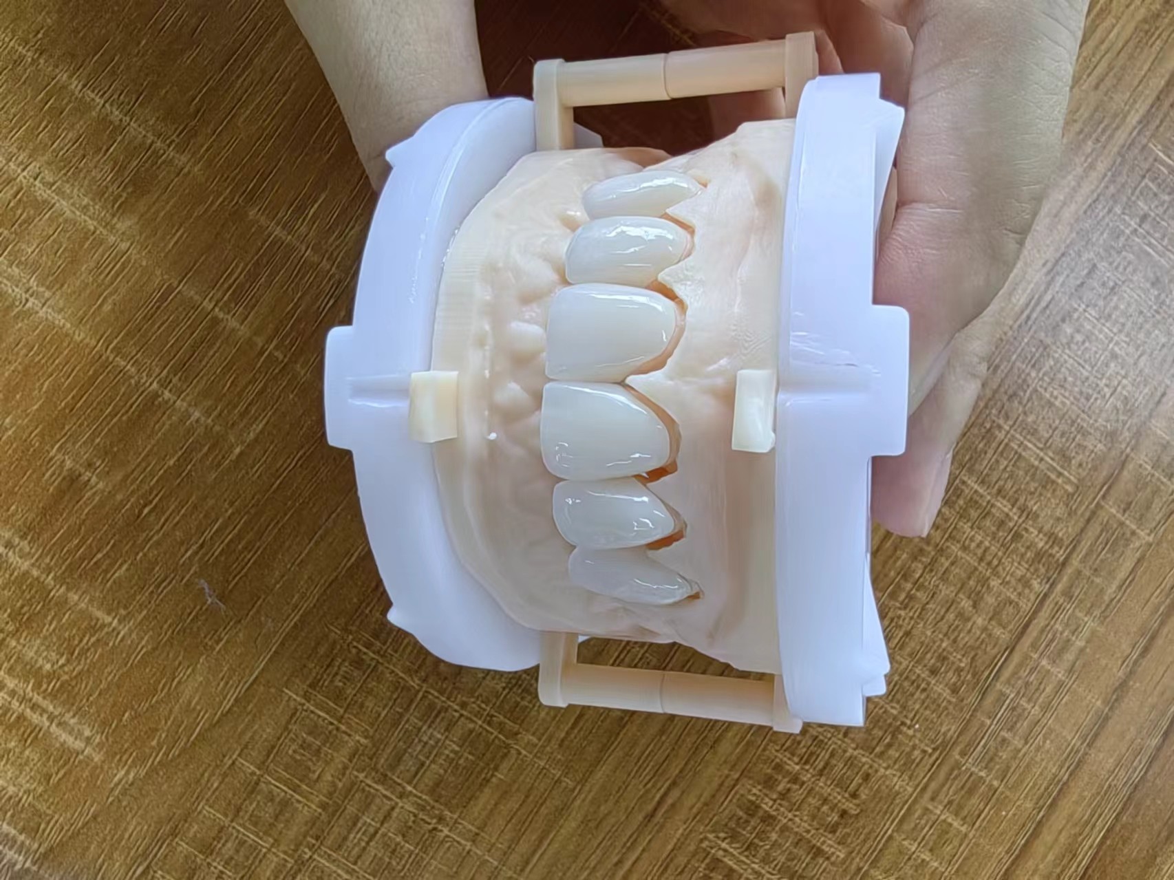 5mm-6mm Layered Zirconia Crowns Strength Zirconia Multilayer Crown