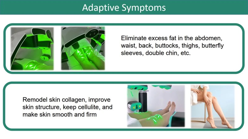 Slim Cold Laser Physiotherapy Machine 10D Green Diode Emerald Laser Fat Reduce Device