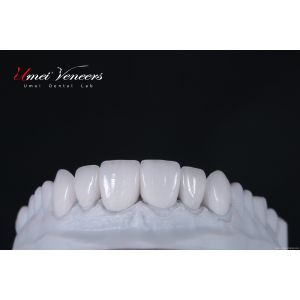 China Natural Whitening Hollywood Veneers wholesale