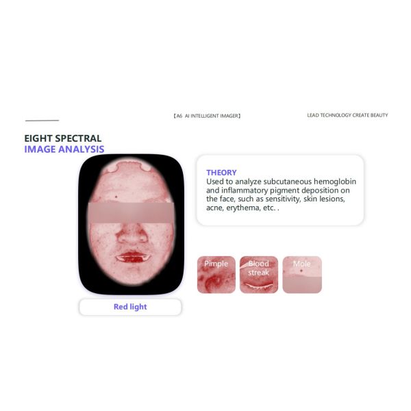 face-detection-skin-report-skin-analysis