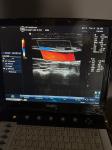 Original Portable Ultrasound Scan Machine , GE Logiq E Medical Ultrasound