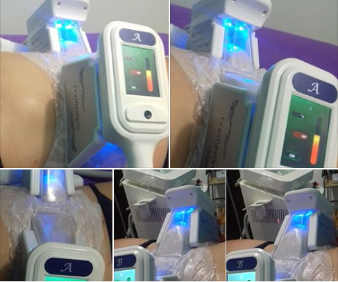 2019 New Upgrated 3 Cryo Cool sculpting machines & Cryolipolysis ultrasound cavitation rf equipment