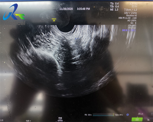 GE IC9-RS Endocavity Ultrasound Transducer Probe Ultrasound Machine