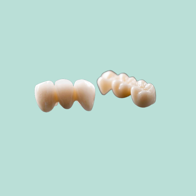 Composite Fixed Bridge Crown Dental Crown Bridge Natural Color Good Stability