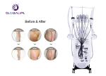 Cryotherapy Fat Reduction Equipment / Body Slimming Machine With Ce Approval