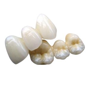 China PFM Co Cr 3014652903 Ceramic Dental Bridge Custom Colour Stability wholesale