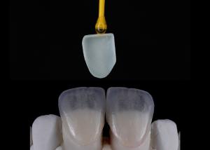 China Custom Made Dental Restoration EMAX Veneers Beautifully Aligned Digital Impression wholesale