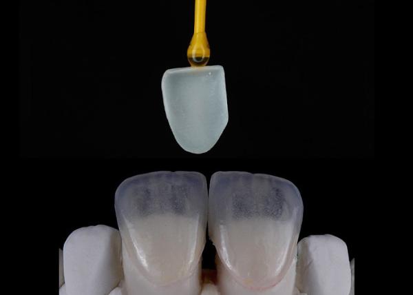 Custom Made Dental Restoration EMAX Veneers Beautifully Aligned Digital