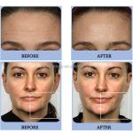 UK Plugs Face Muscle Stimulator Machine STANDING For Skin Tightening