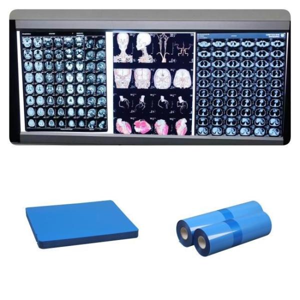 DR CT MRI Medical Inkjet X Ray Films 210 Microns Blue Base Ink 8x10 A4 A3 10inch