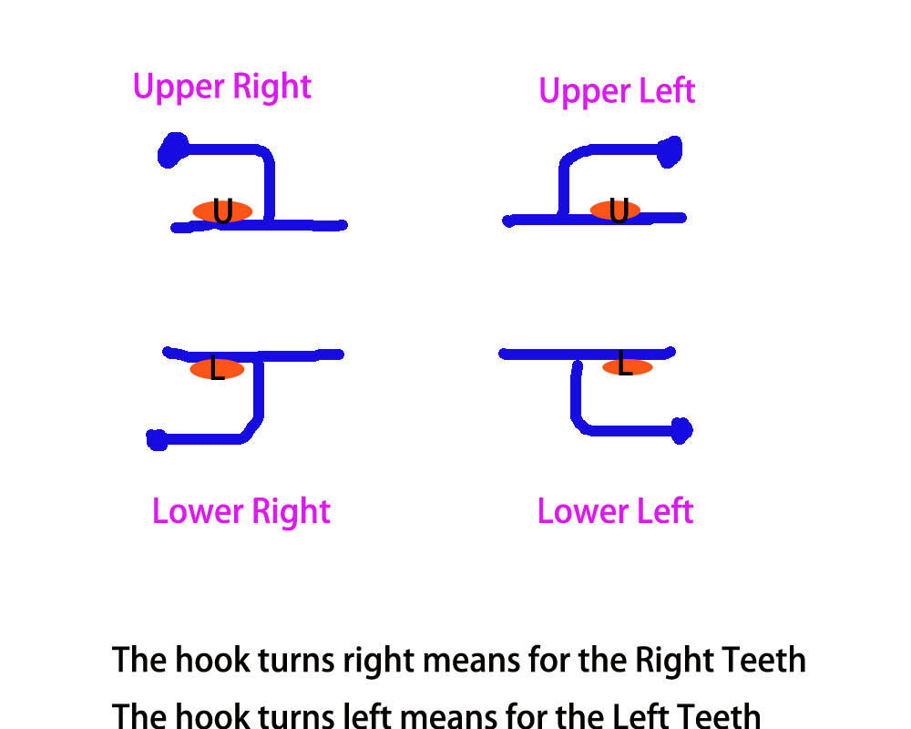 Roth 022 2nd Orthodontic Molar Bands Non Convertible High Strength