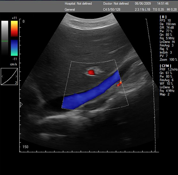 Touch screen color doppler,Protable color doppler,22" color doppler with convet probe SGC6