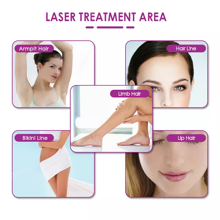 ce approved diode laser newest 808nm diode laser removal machine diode laser 755 808 1064nm 1600w salon beauty equipment price