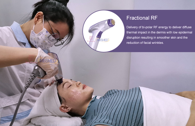 Portable Microneedling RF Fractional Radio Frequency Home Use Beauty Equipment For Salon Facelift Skin Tightening
