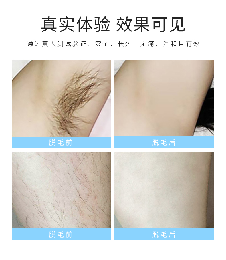 White Home Permanent Hair Removal System Laser Hair Removal Small Machine