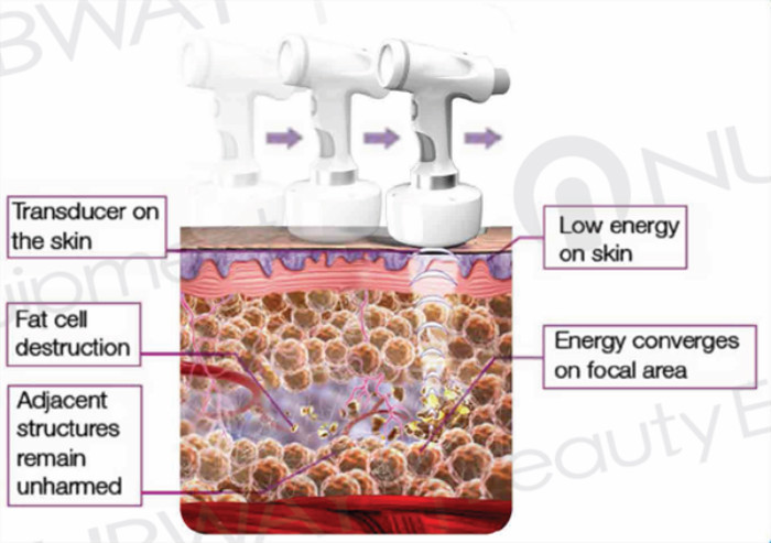 Hot promotion!!! HIFU body slimming vacuum slim equipment&machine