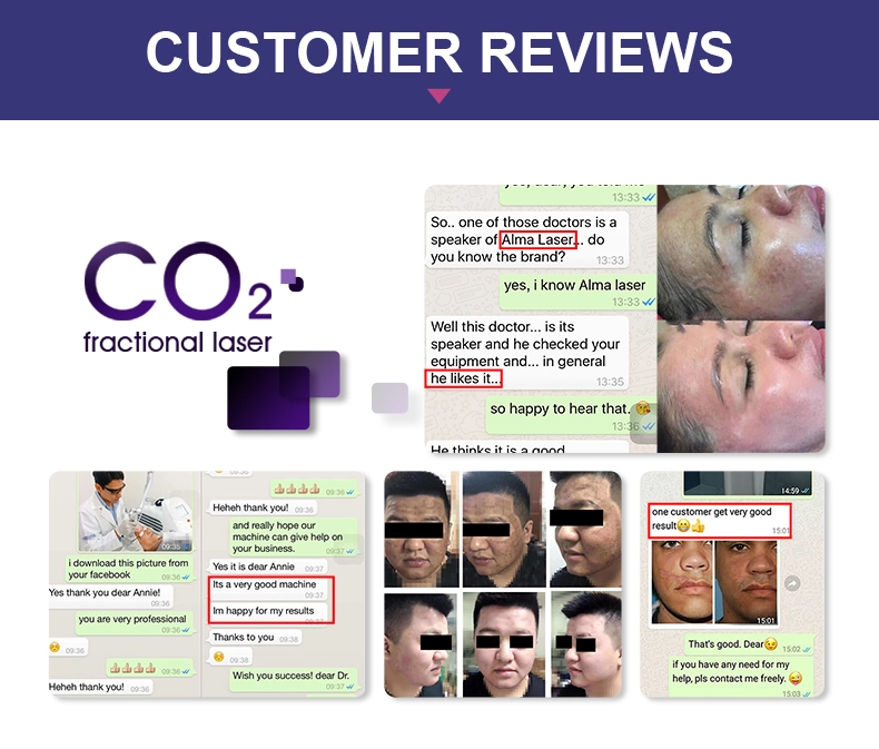 Vaginal Tightening Fractional Co2 Laser Machine 10600nm